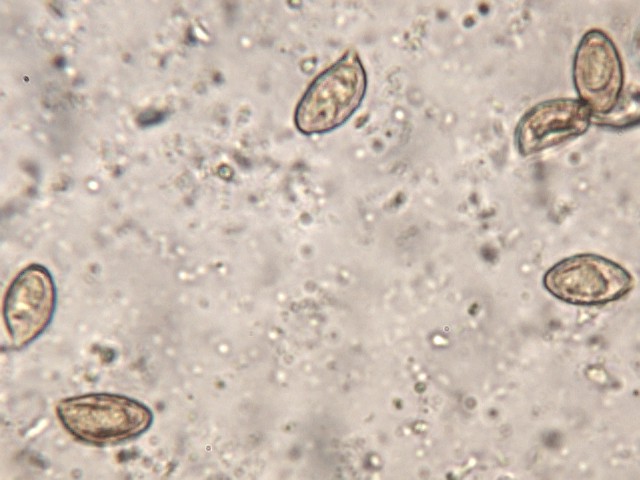 Cortinarius ochropallidus?